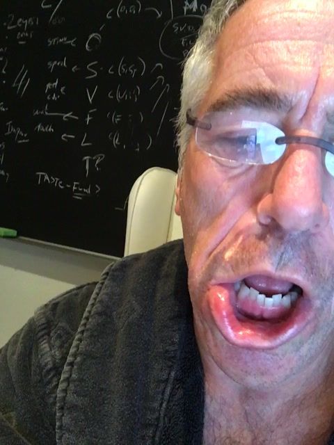 dentis said its fine tho